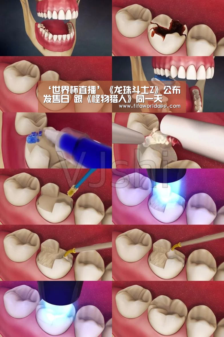 比赛集锦